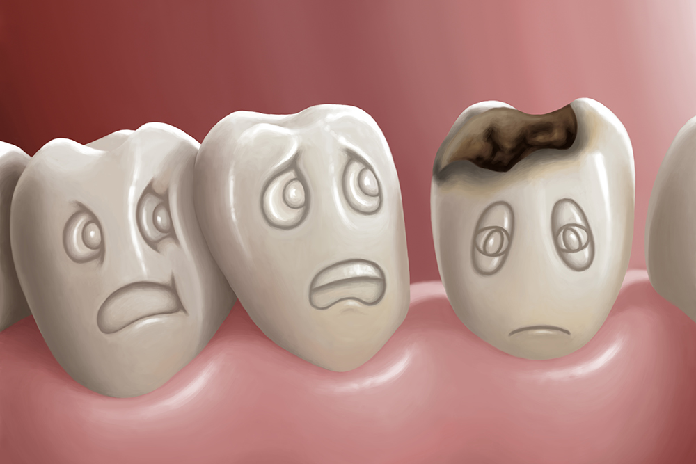 虫歯を放置する危険性