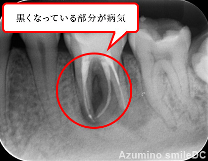 デジタル化により患者様の負担やストレスを軽減させる治療