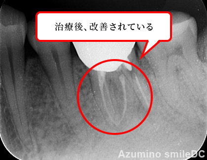 デジタル化により患者様の負担やストレスを軽減させる治療