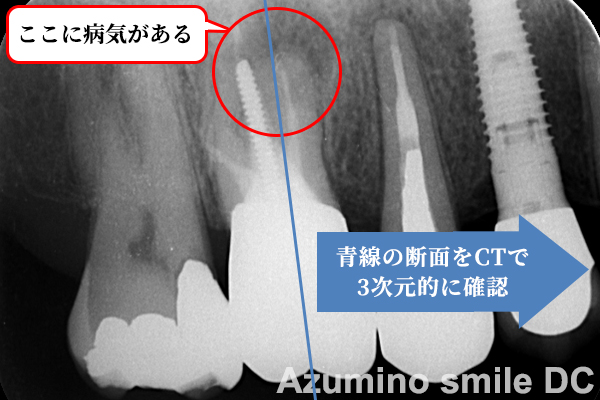 レントゲンでは詳しく症状が確認できない