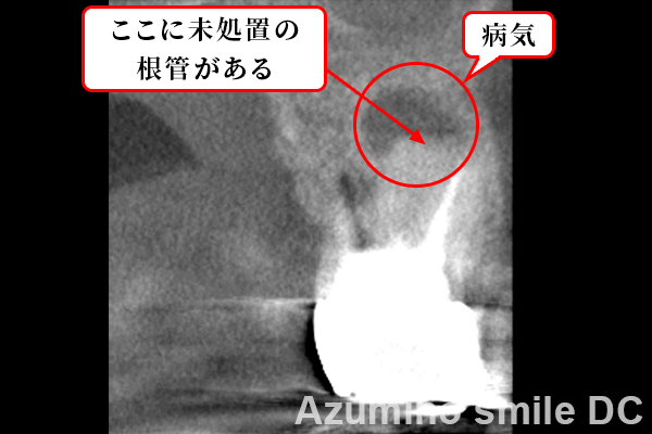 CTで病気を確認