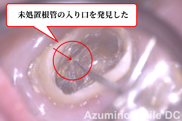 3次元で確認できるCTとマイクロスコープで病気を確認