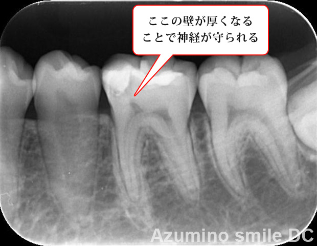 術後4カ月